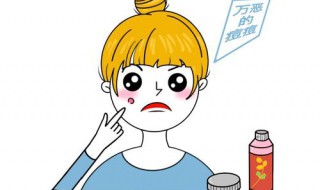 长了痘痘怎么处理 长痘痘的处理方法