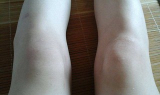 让膝盖变瘦的方法 这样做膝盖会越来越瘦