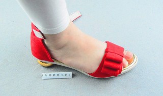 脚掌底摩擦起包怎么处理 有什么改善的办法