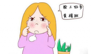 女人脸上长黄褐斑怎么办 平时要注意什么？