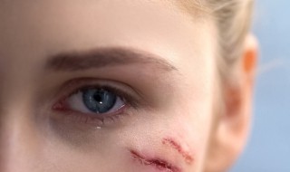 怎么样消除脸上的疤 外敷内服科学祛疤痕方法介绍