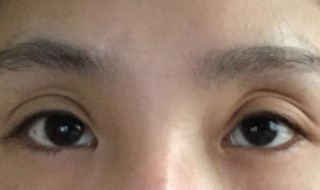 怎样变双眼皮 变双眼皮的方法