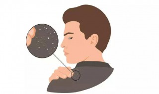 最简单快速去除头皮屑 最简单快速去除头皮屑方法是什么