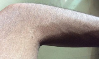 体毛重怎么处理 有什么解决的办法