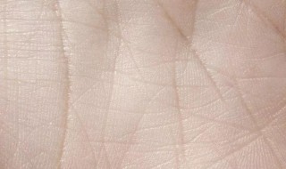 黑棘皮去掉方法 黑棘皮去掉方法详解