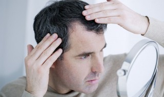 头皮痒头皮屑多有可能传染吗 头皮屑多该怎么办
