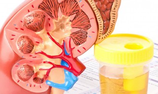 尿素偏低是什么意思 尿素偏低的意思是什么