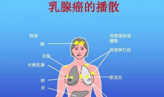 乳腺癌为什么胳膊肿 手术后就一直会这样吗