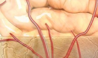 急性脑梗死能恢复好吗 急性脑梗死治疗方法