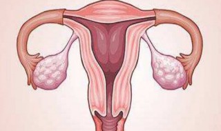 子宫肌瘤能喝柠檬水吗 最真实的经验分享
