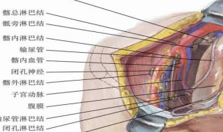 腹膜后淋巴结钙化原因 综合有三大原因