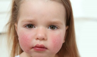 小孩为什么会的甲状腺怎么治 早治疗早放心