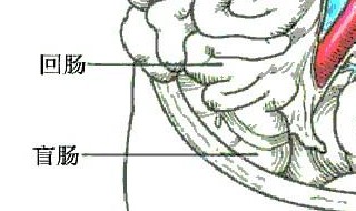 直乙状结肠炎严重吗 为你分析清楚这种病症