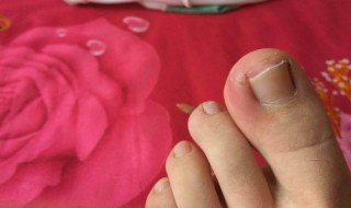 脚趾发热怎么回事 请看回复