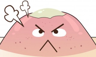 额头长痘痘怎么去除 额头长痘痘如何去除