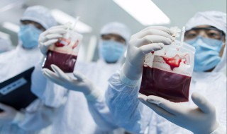 保存脐带血有必要吗 脐带血有必要保存吗