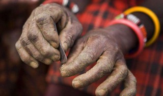 非洲女性割礼是什么意思？ 关于非洲女性割礼的意思介绍