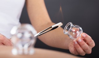 肚子上拔罐减肥的方法 肚子上拔罐怎么减肥