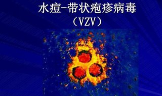 泡诊病什么原因引起的 看看医生怎么说