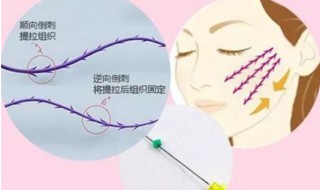 面部提升手法 跟着这样学