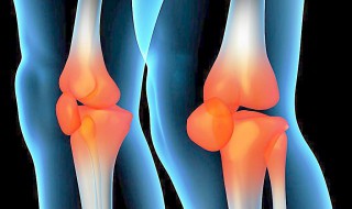 膝盖响疼怎样预防保护 膝盖响疼怎么办