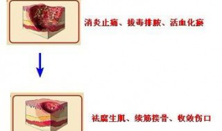伤口愈合特效药 要注意什么
