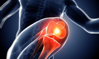 骨癌的六个早期症状 夜晚四肢痛警惕骨癌