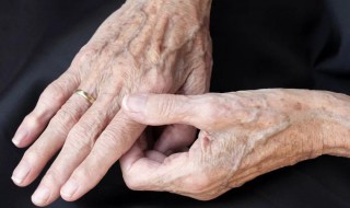 男性老年斑的克星 八大偏方治好它