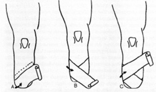 魔纹绷带在哪学 应该这样做