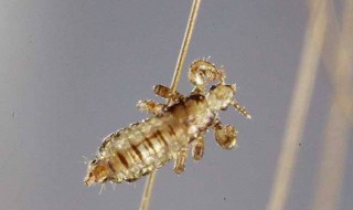 生虱怎么办 解决方法