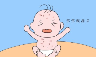 防止生痱子方法 防止生痱子方法分享