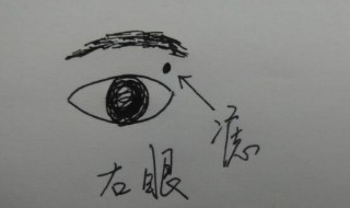 眼睛下面有痣代表什么 眼睛下面有痣有什么意义