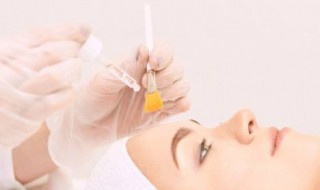 刷酸什么意思 刷酸具体是什么意思