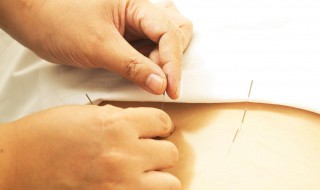 针灸绝对不能天天扎 针灸绝对不能天天扎的原因