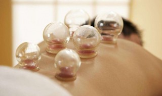 伏天拔罐的好处 伏天拔罐有什么好处