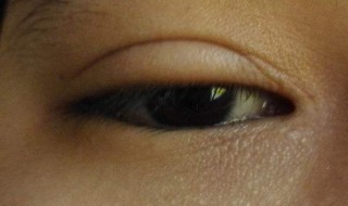 左眼上皮跳是什么原因 用什么治疗手段比较好