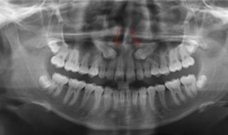没用的x光片怎么处理 利用医疗废品报废X光片diy台灯制作教程