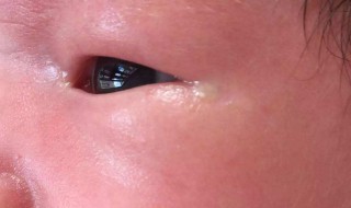 婴儿左眼流泪眼屎多是怎么回事 一起了解一下