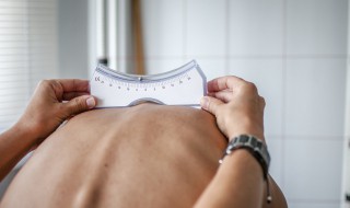 剃刀背如何锻炼 如何自我矫正脊柱侧弯