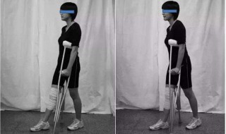 拐杖的正确使用方法 如何正确使用拐杖呢