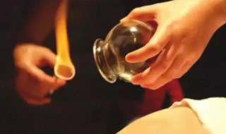 拔罐的注意事项及禁忌症 拔罐的注意事项介绍