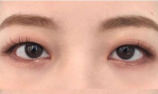 割完双眼皮红痒可以恢复吗 需要具体分析的