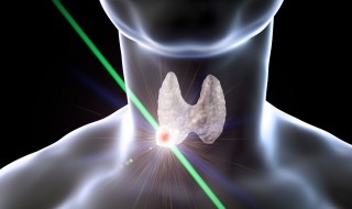 tirads4a类什么意思 ti-rads-4a类是什么