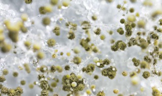 霉菌性阴炎栓剂怎么使用 霉菌性阴炎栓剂使用方法