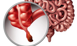 半月形阑尾开口什么意思 半月形阑尾是病吗