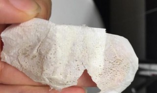 什么去黑头效果好 如何祛除黑头