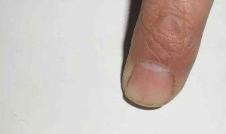 简易补墙孔方法 墙壁有孔怎么填补