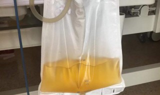 导尿管从哪进 是怎么样的啊