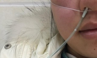 头缺氧的症状有哪些 最后会如何