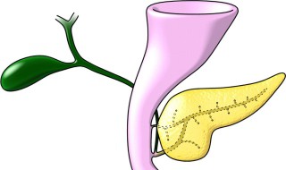 胰腺癌死前的征兆 如以下几点